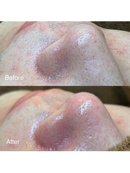 ピエル 柏店(PIEL)/メンズ専用クーポンあり