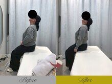 リン 大宮院(RIN)/Before/After