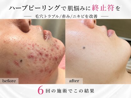 エステサロン ジョアアンジェ(joie ange)の写真