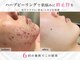 エステサロン ジョアアンジェ(joie ange)の写真