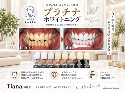 ティアナ 神栖店(Tiana)の写真