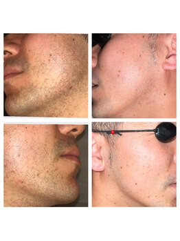 エンムスビ(enmusubi)/