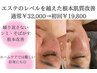 《繰り返すシミ徹底改善コース》シミ悩み0へ根本肌質改善/毛穴洗浄付き