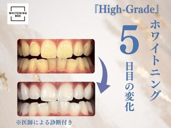 ホワイトニングボックス 豊川店/施術5回目終了後