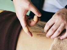 鍼処シラカワ なごや院千種(鍼処SHIRAKAWA)/