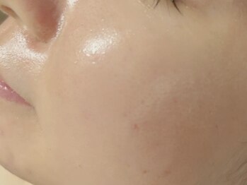 ビハニエルの写真/素肌偏差値UPの、美肌メソッドがここに♪年齢とともに現れる悩みにもアプローチ！自分史上最高の肌へ！