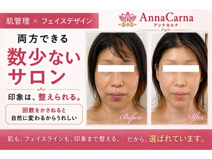 アンナカルナ(AnnaCarna)の写真
