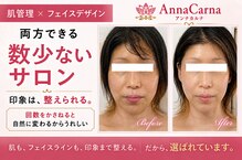 アンナカルナ(AnnaCarna)
