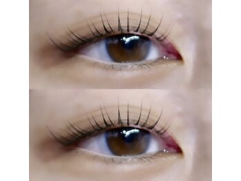 フィールリファイン(Feel Refine)/ラッシュリフト