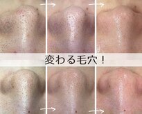プアラ(puala)