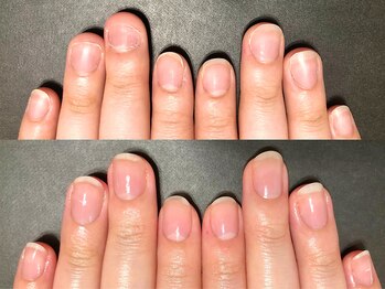 ブラン(blanc)の写真/素爪に自信を持ちたい方必見！爪のお悩み（噛み爪・深爪・二枚爪・割れ爪・縦筋）を丁寧に解消します♪