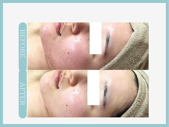 スリムライン 青森店(The Slim Line)/before→after