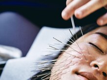 鍼処シラカワ なごや院千種(鍼処SHIRAKAWA)/