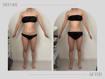 リー(Riy)/《Before and After》20代