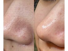 サイ(Sai)/気持ち高まる”褒められ肌”