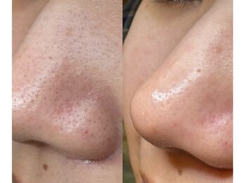 サイ(Sai)/気持ち高まる”褒められ肌”