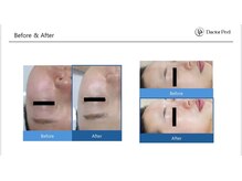 ジスドット(JISOO.)