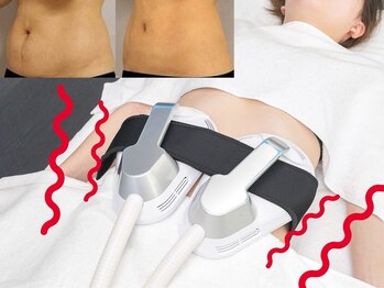 ソワンの写真/【痩せたいアナタへ】ソワンのダイエットは高い成功率!初めての方やリバウンド続きの方にも絶対おススメ!