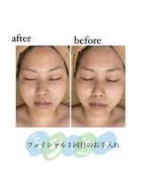 そらまめ/フェイシャル1回目です