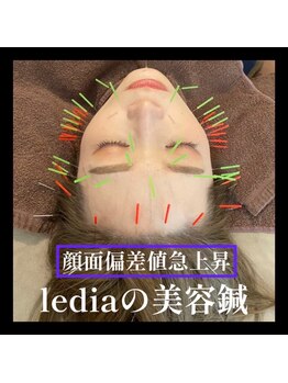 ルディア 堂島店(ledia)/大阪美容鍼で顔面偏差値急上昇!