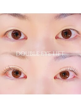 バービーヒルズ/ダブルアイリフト