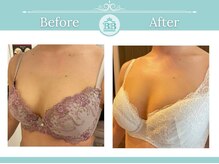 美人バスト 千早店/バストアップ◇育乳症例◇