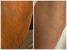 フェリス(FELIZ)/足だけ気になる方はこちら