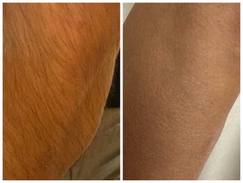 フェリス(FELIZ)/足だけ気になる方はこちら