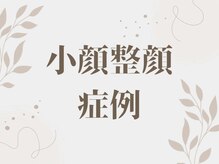 イオム ビューティワーク(IOM BEAUTY WORK)/