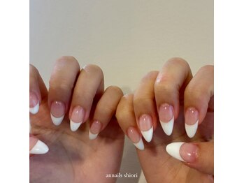 アンネイルズ(annails)/