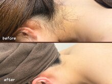 ミース 福岡赤坂店の雰囲気(うなじ矯正専門サロン☆プロが自然で綺麗なうなじに仕上げます!)