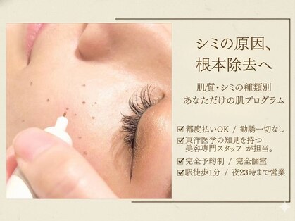 ジーニー(genie)の写真