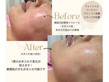 チャロアイト 可部店(Charoite)の雰囲気（グランプリ受賞スタッフ在籍。本気の肌改善しませんか？）