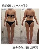 シャルム(CHARME)/新感覚筋膜リリース