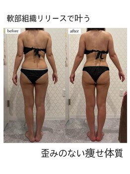 シャルム(CHARME)/新感覚筋膜リリース