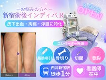 術後インディバ アール 新宿(R)