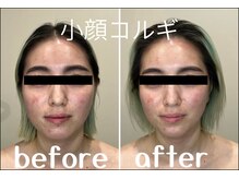 ルナ(LUNA)の雰囲気（【 新メニュー 】顔のむくみ、首肩の凝り、眼精疲労に効果抜群◎）
