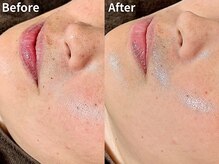 ミエル(Miel)の雰囲気（【エステ版ポテンツァ】ハリツヤ×なめらか肌へ）
