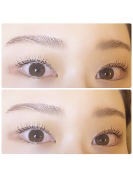 シュシュ(chou chou)/