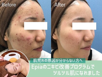 エピア 半田店(Epia)の写真