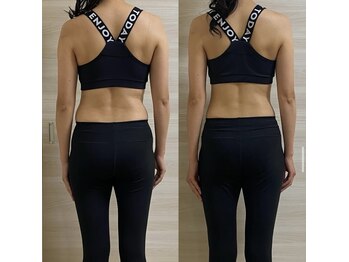 リノア(LINORE)/背中スッキリ