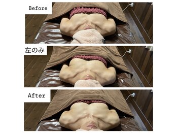 リノレア(LinoLea)/