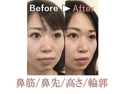 ラプリ 新宿店(Raplit)の写真