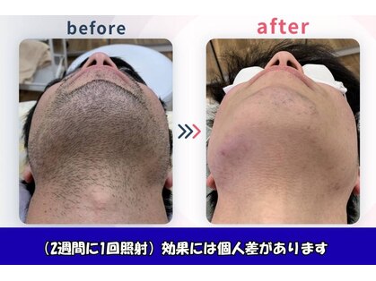 ネクストプラス 大分別府店(NEXT+)の写真