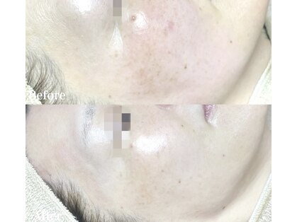 ロータス 千早香椎店(Lotus.)の写真