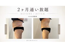 ヴォアール 東静岡店(VOIR)の雰囲気（本気痩せの方限定！脂肪冷却で気になる脂肪にアプローチ！）