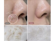 スキニティ 池袋(sknity)の雰囲気（【池袋】毛穴診断×本格ハーブピーリングで陶器のような素肌へ）