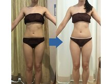 ピュアトゥルー 岐阜西店(PureTrue)/余分なお肉に高周波！ラジオ派！