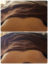 セラフ(Seraph)/バスト