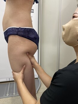 コスメティックアート 新潟店/脂肪チェック